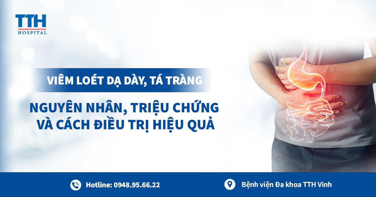 Viêm Loét Dạ Dày Tá Tràng: Nguyên Nhân, Triệu Chứng và Cách Điều Trị Hiệu Quả